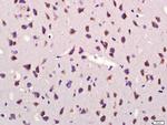 GDF10 Antibody in Immunohistochemistry (Paraffin) (IHC (P))