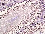 GDF10 Antibody in Immunohistochemistry (Paraffin) (IHC (P))