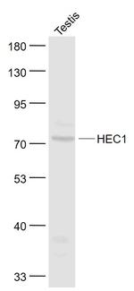 HEC1 Antibody in Western Blot (WB)