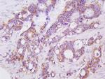 LGALS3BP Antibody in Immunohistochemistry (Paraffin) (IHC (P))