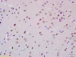 PCGF1 Antibody in Immunohistochemistry (Paraffin) (IHC (P))