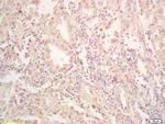 FES Antibody in Immunohistochemistry (Paraffin) (IHC (P))