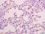 PPP2R3 Antibody in Immunohistochemistry (Paraffin) (IHC (P))
