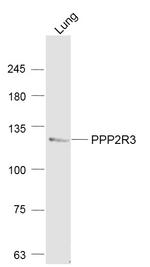 PPP2R3 Antibody in Western Blot (WB)
