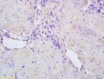 Activin A Receptor Type IC Polyclonal Antibody