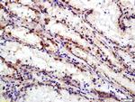 Integrin Alpha V + Beta 6 Antibody in Immunohistochemistry (Paraffin) (IHC (P))