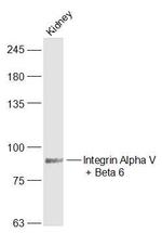 Integrin Alpha V + Beta 6 Antibody in Western Blot (WB)