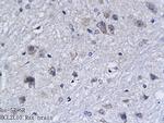 BCL2L10 Antibody in Immunohistochemistry (Paraffin) (IHC (P))