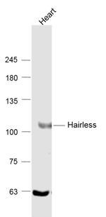 USP28 Antibody in Western Blot (WB)