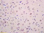 RAB21 Antibody in Immunohistochemistry (Paraffin) (IHC (P))