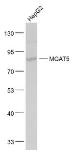 MGAT5 Antibody in Western Blot (WB)