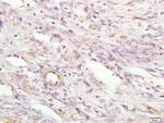 MIIP Antibody in Immunohistochemistry (Paraffin) (IHC (P))