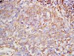 Hyaluronidase2 Antibody in Immunohistochemistry (Paraffin) (IHC (P))