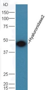 Hyaluronidase2 Antibody in Western Blot (WB)
