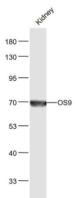 OS9 Antibody in Western Blot (WB)