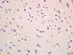 MAS1L Antibody in Immunohistochemistry (Paraffin) (IHC (P))