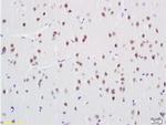 ANP32C Antibody in Immunohistochemistry (Paraffin) (IHC (P))