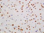 KLHL7 Antibody in Immunohistochemistry (Paraffin) (IHC (P))