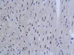 SnoN Antibody in Immunohistochemistry (Paraffin) (IHC (P))