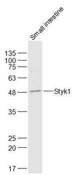 Styk1 Antibody in Western Blot (WB)