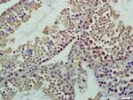 CASC5 Antibody in Immunohistochemistry (Paraffin) (IHC (P))