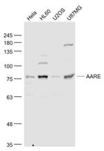 AARE Antibody in Western Blot (WB)