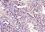 HSP40 homolog Antibody in Immunohistochemistry (Paraffin) (IHC (P))