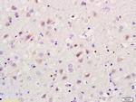 RBBP5 Antibody in Immunohistochemistry (Paraffin) (IHC (P))
