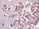CD200 Antibody in Immunohistochemistry (Paraffin) (IHC (P))