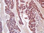 CD200 Antibody in Immunohistochemistry (Paraffin) (IHC (P))