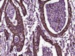 CD200 Antibody in Immunohistochemistry (Paraffin) (IHC (P))