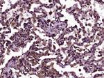 CD200 Antibody in Immunohistochemistry (Paraffin) (IHC (P))