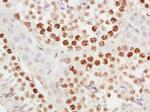 METTL11A Antibody in Immunohistochemistry (Paraffin) (IHC (P))