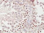METTL11A Antibody in Immunohistochemistry (Paraffin) (IHC (P))