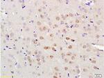 LLGL1 Antibody in Immunohistochemistry (Paraffin) (IHC (P))