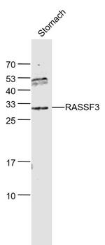 RASSF3 Antibody in Western Blot (WB)