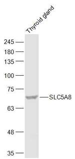SLC5A8 Antibody in Western Blot (WB)