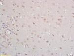 Tomoregulin-1 Antibody in Immunohistochemistry (Paraffin) (IHC (P))