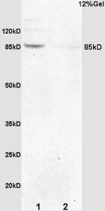 p95 NBS1 Antibody in Immunohistochemistry (Paraffin) (IHC (P))