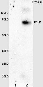 Phospho-p95 NBS1 (Ser343) Antibody in Western Blot (WB)