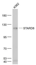 STARD8 Antibody in Western Blot (WB)