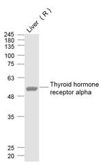 THRA1 Antibody in Western Blot (WB)
