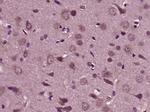 HRG beta 1 Antibody in Immunohistochemistry (Paraffin) (IHC (P))