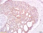 TAAL6 Antibody in Immunohistochemistry (Paraffin) (IHC (P))