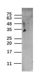TAAL6 Antibody in Western Blot (WB)