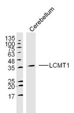 LCMT1 Antibody in Western Blot (WB)