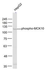 Phospho-MCK10 (Tyr513) Antibody in Western Blot (WB)