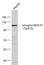 Phospho-MCK10 (Tyr513) Antibody in Western Blot (WB)