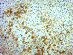 Ret Antibody in Immunohistochemistry (Paraffin) (IHC (P))
