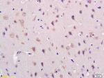 Acylglycerol Kinase Antibody in Immunohistochemistry (Paraffin) (IHC (P))